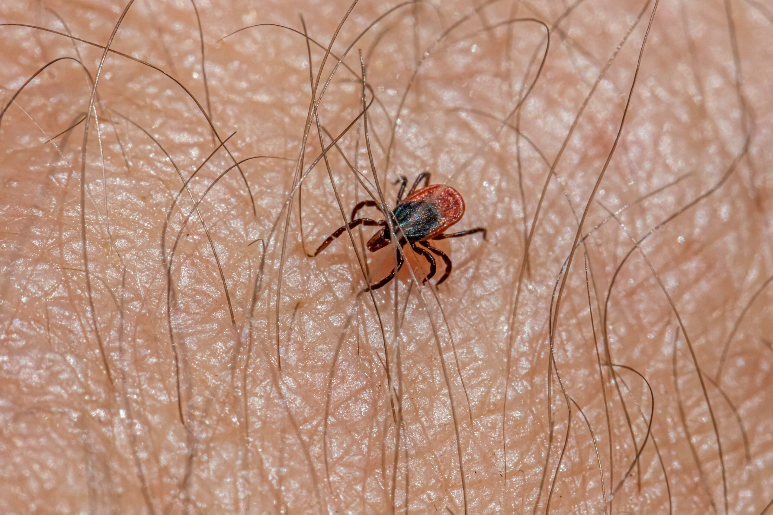 Veiksmingiausios natūralios priemonės apsaugai nuo erkių 